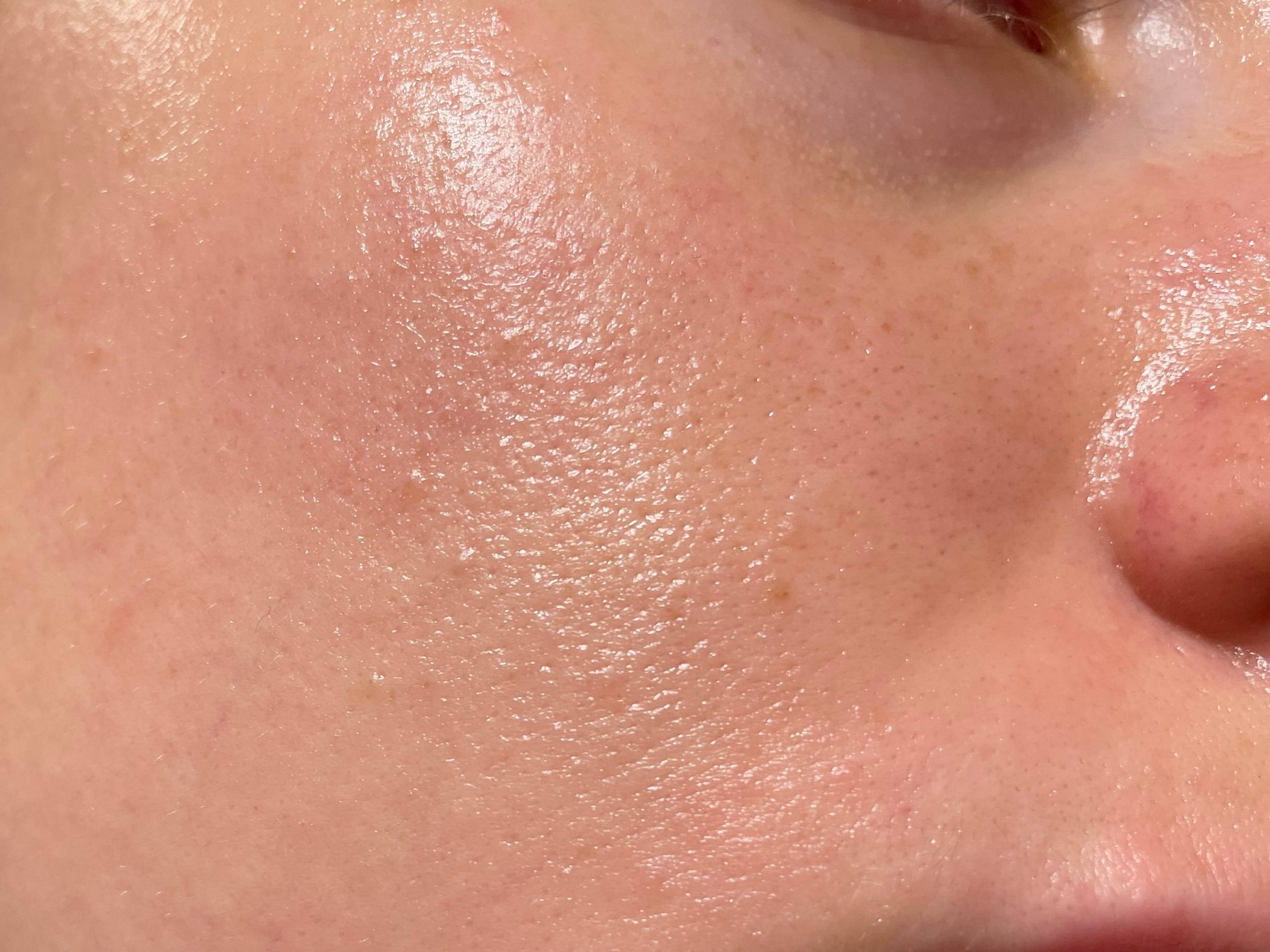 Best Serum for Oily Skin in Pakistan | Oil Control That Actually Works