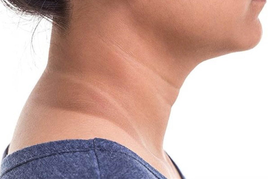 Dark Neck: Why It Happens and What It Might Be Telling You
