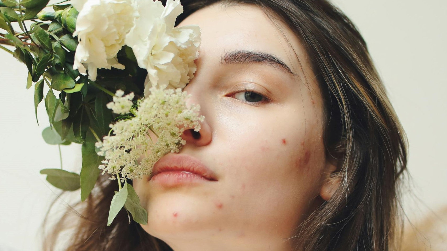 How to Remove Acne Marks from Face | The Complete Guide