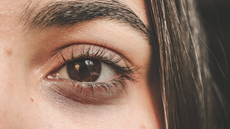 Dark Circles Under Eyes in Pakistan: What Actually Causes Them and What Works